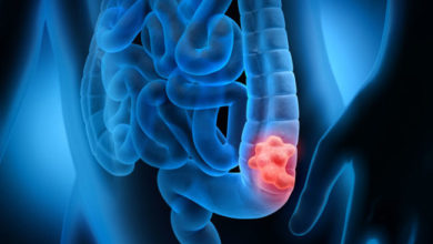 CANCER colorrectal