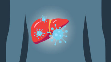 hepatitis,