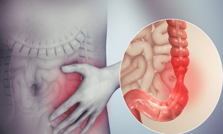 Enfermedad intestinal