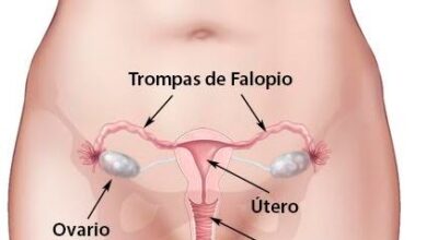 Cáncer de Ovario