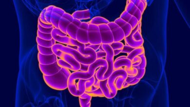 Cáncer colorrectal