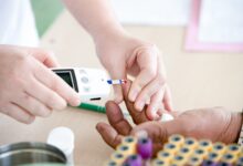 Diabetes y Endocrinologia