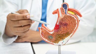 Cáncer de páncreas