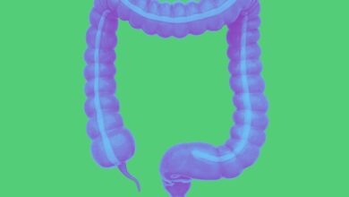 colitis