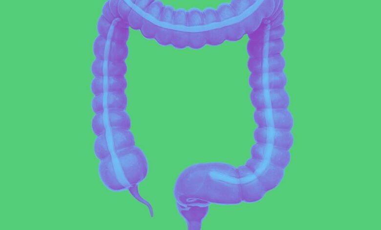 colitis