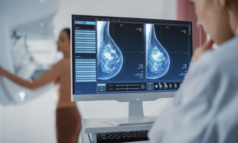 Cáncer de mama y los Biomarcadores