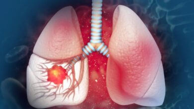 Cáncer y tabaco