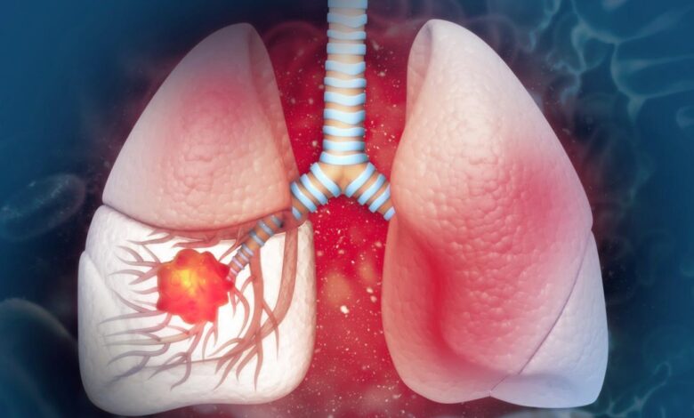 Cáncer y tabaco