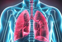Pulmonar