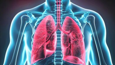 Pulmonar